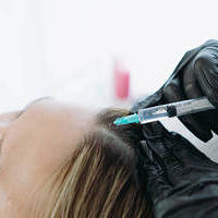 Exosomes Therapy for Hair Loss in Riyadh