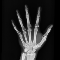 #xraysergeycoub
