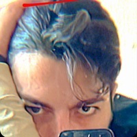 Bug