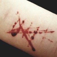 depressed