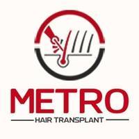 metrohairtransplan