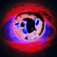 Psychosis