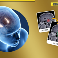 Billionaire brainwave