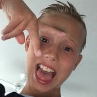 Dumb Kid