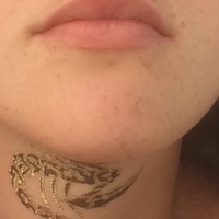 Pea