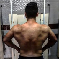 muscular