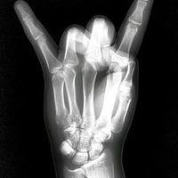 X-Ray Channel