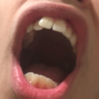 Trash Mammal