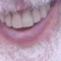 მე <3 პატრიარქის ქვედა ტუჩიი