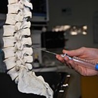 Epidural